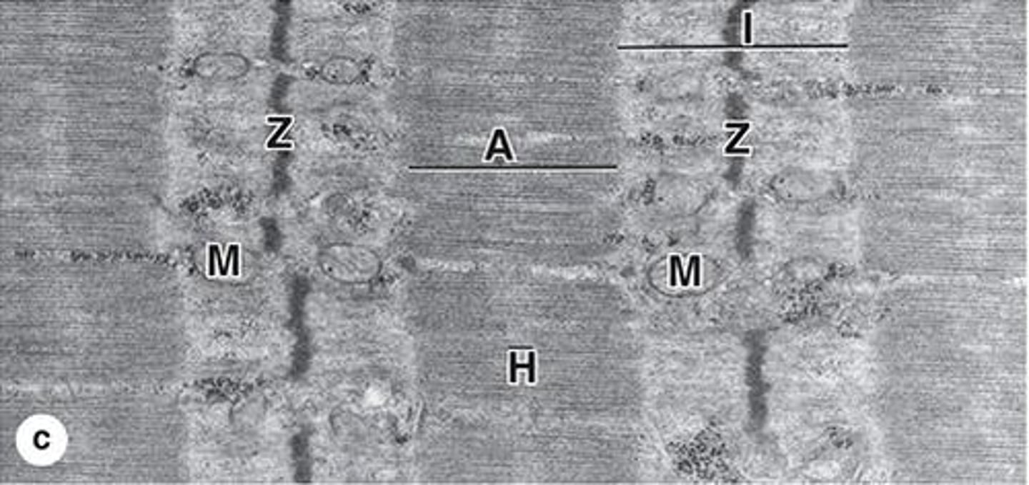 <p>Functional unit of contraction between Z discs.</p>