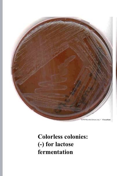 <p>What does colorless indict for EMB</p>