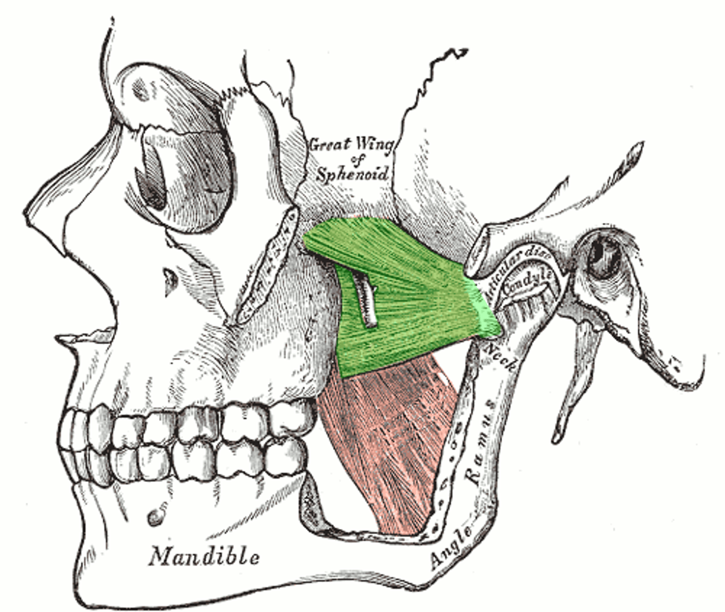 <p>Lateral Pterygoid</p>