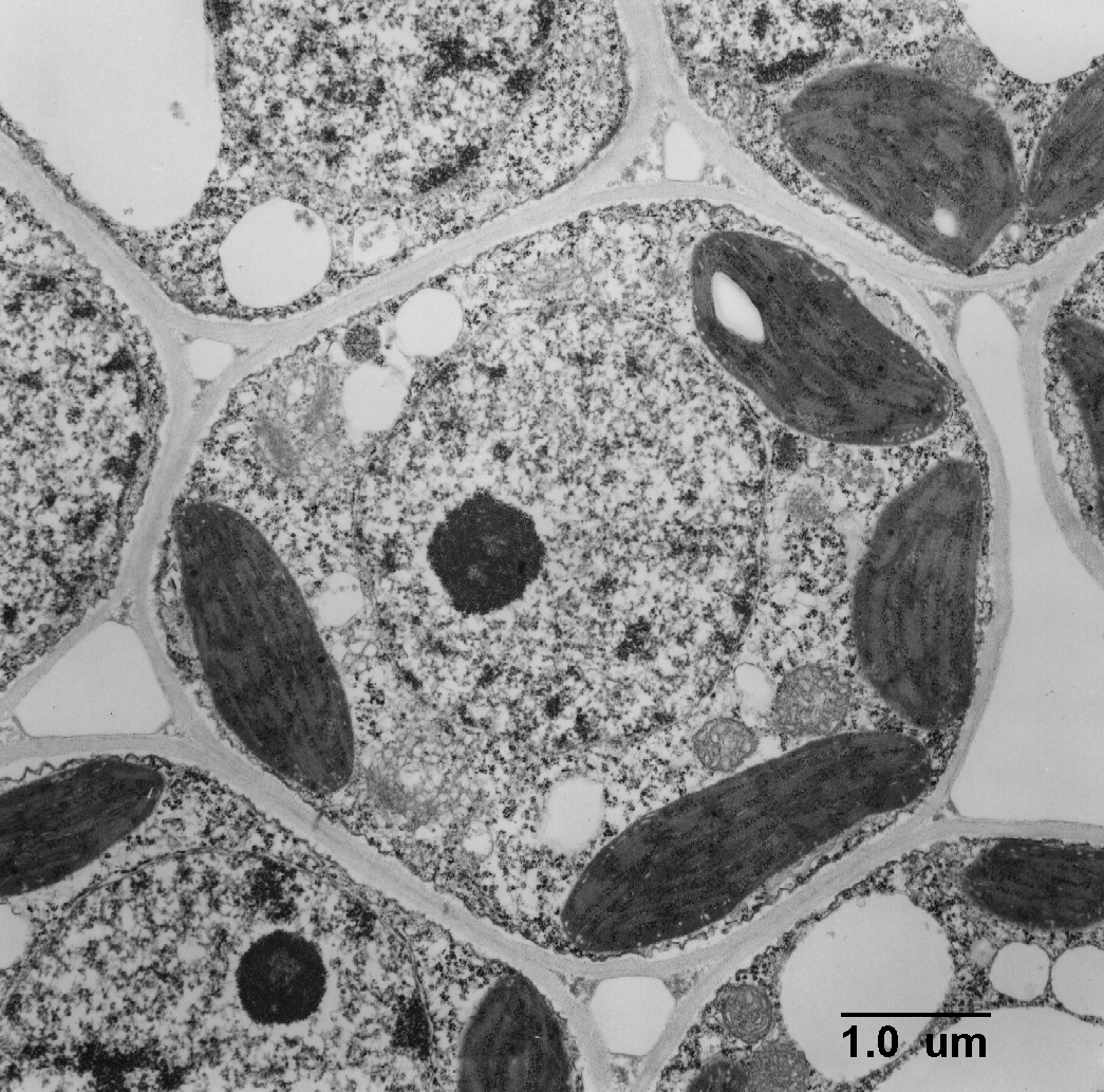 <p>Prokaryote, plant or animal cell?</p>