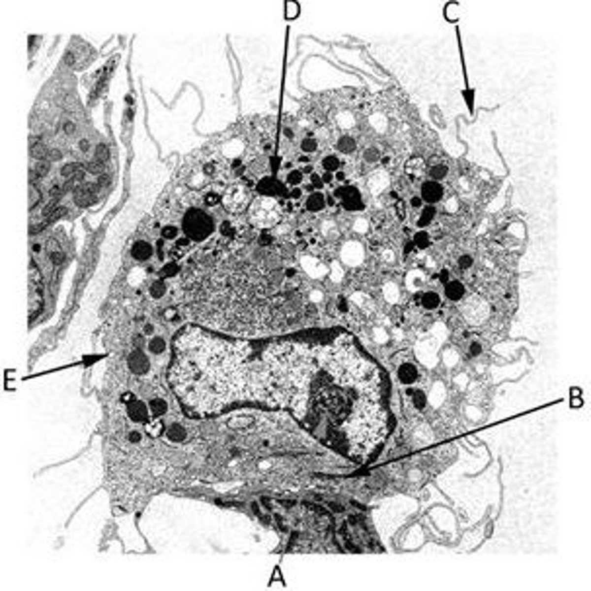 <p>A) A nucleolus</p><p>B) A Golgi body</p><p>C) A cytoplasmic extension (a pseudopod)</p><p>D) A lysosome</p><p>E) A pinocytic vesicle</p>