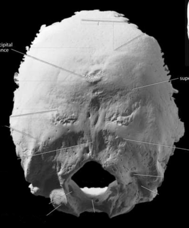 <p>Identify the foramen magnum </p>
