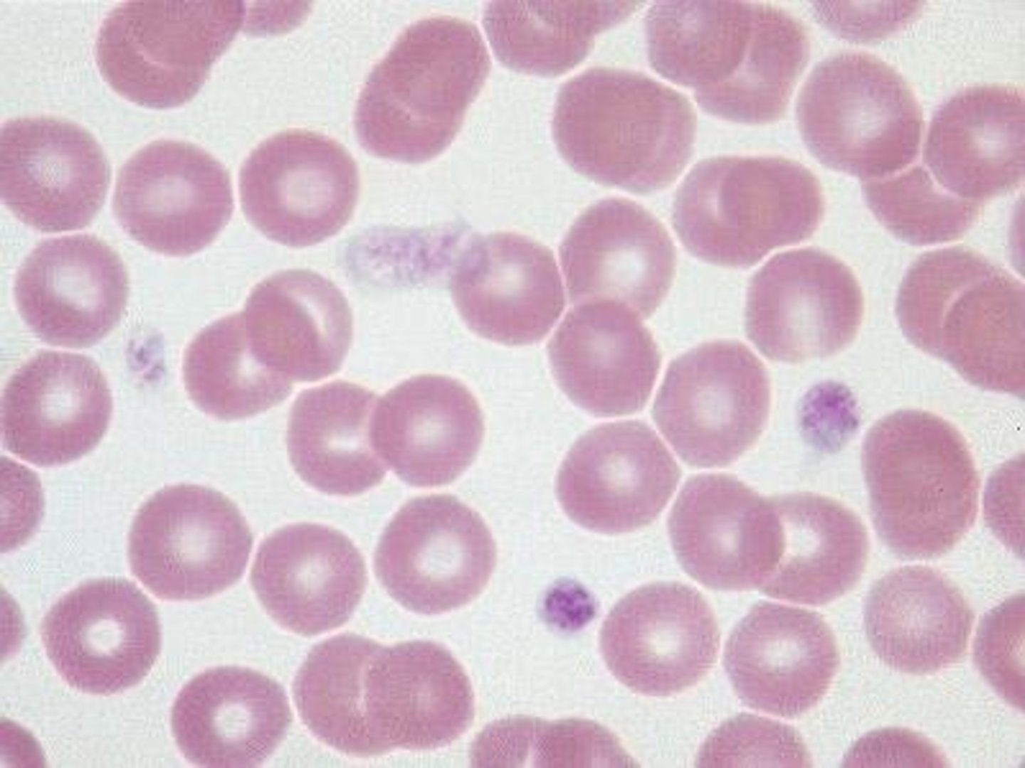 <p>Red blood cells transporting oxygen and carbon dioxide.</p>