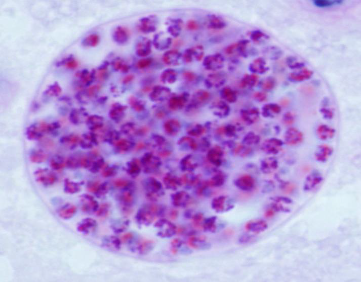 <p><strong>1. Identify the parasite (Genus, species, and stage).</strong></p><div data-type="horizontalRule"><hr></div><p><strong>2. Mention two morphological characters of this stage.</strong></p><div data-type="horizontalRule"><hr></div><p><strong>3. Mention the active form of this parasite.</strong></p><div data-type="horizontalRule"><hr></div><p><strong>4. Identify the types of antibodies detected in serological diagnosis of this disease and their significance.</strong></p><div data-type="horizontalRule"><hr></div><p><strong>5. Mention two immunological tests to augment diagnosis.</strong></p>