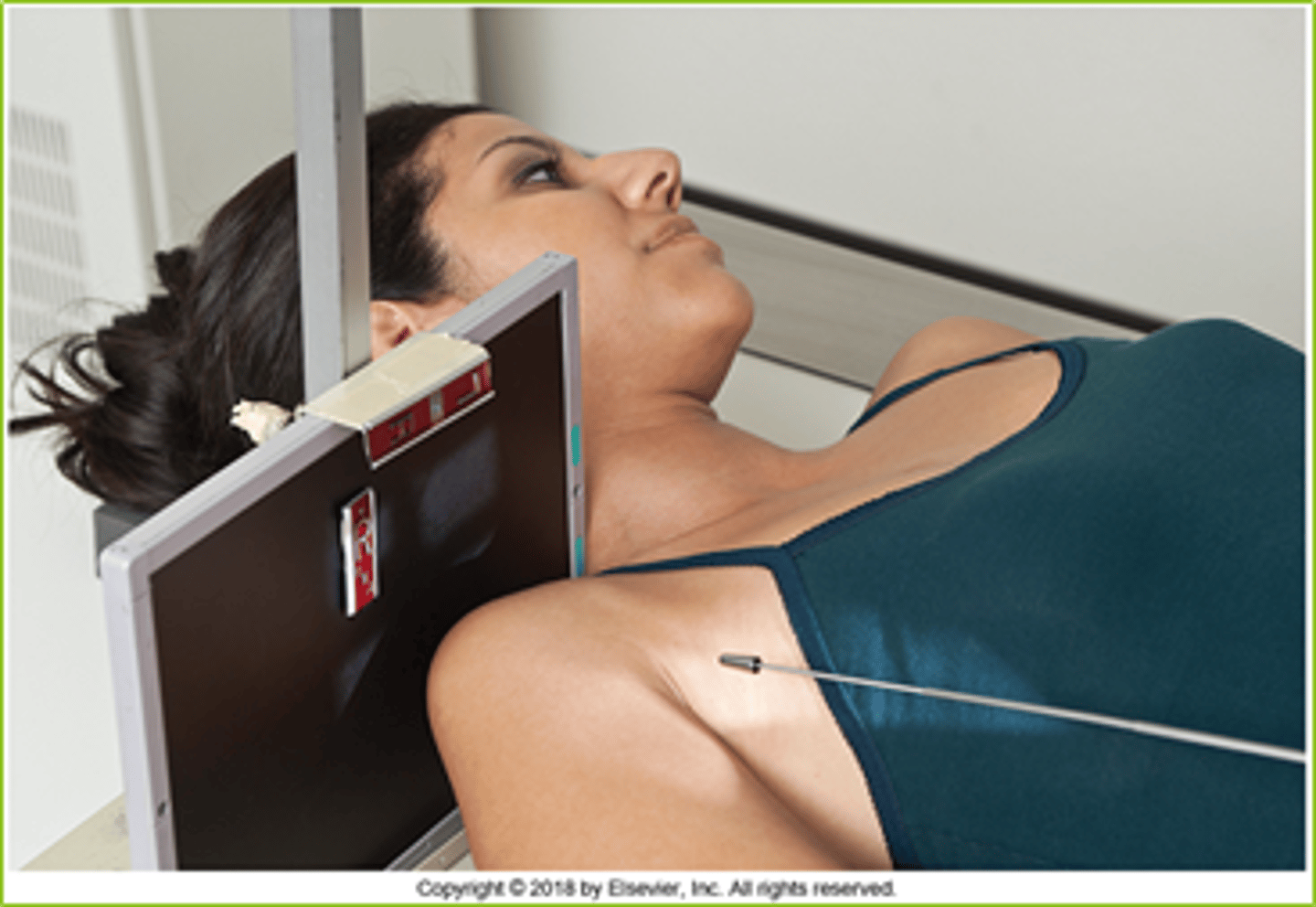 <p>CR 10-15° from horizontal to intertubercular groove</p>