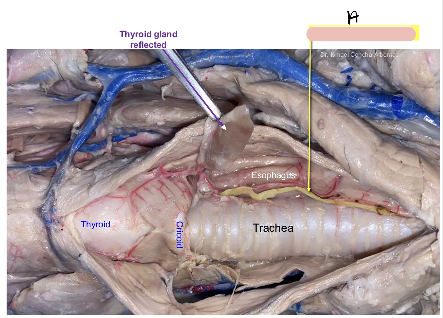 <p>Name the structure(s) indicated by a.</p>