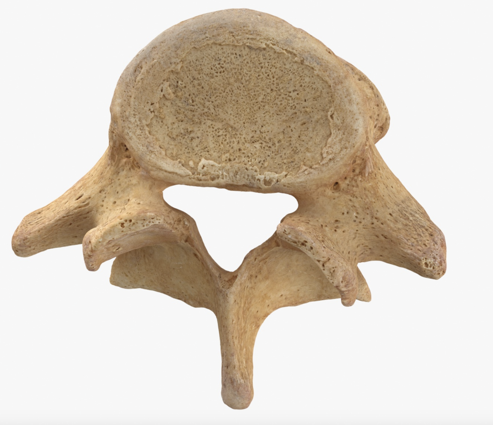 <p>What vertebra is this?</p>
