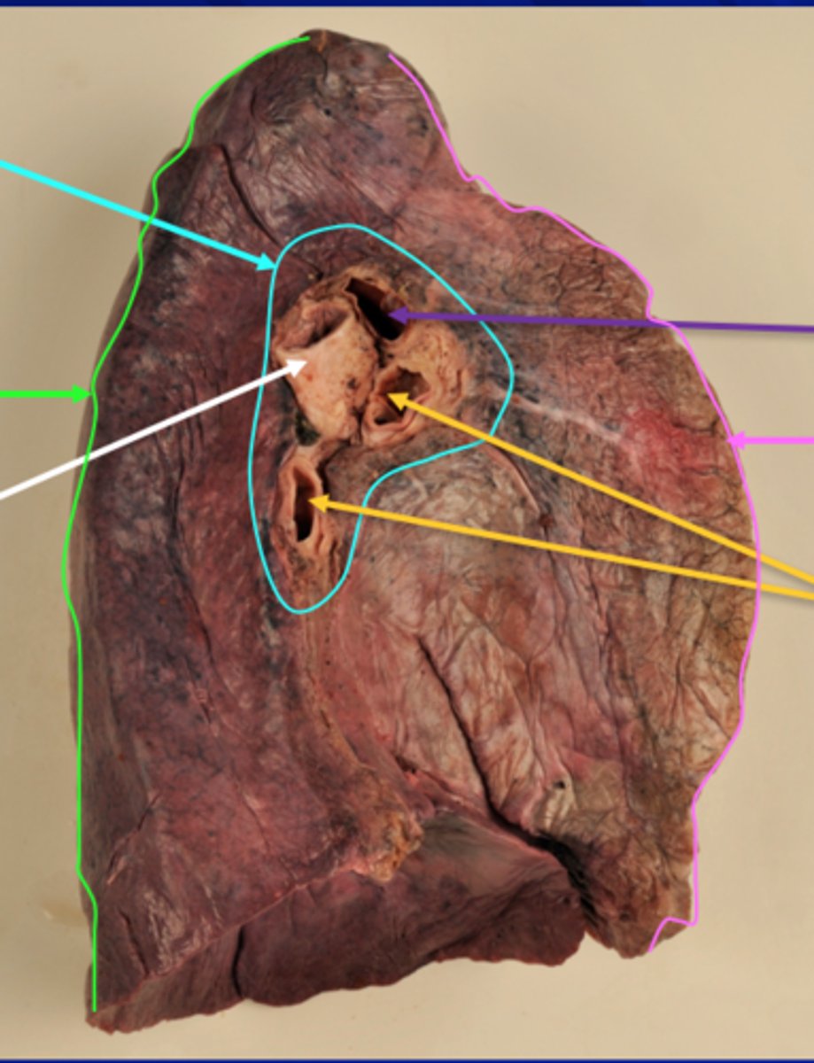 <p>Label the Veins (Yellow Arrows)</p>
