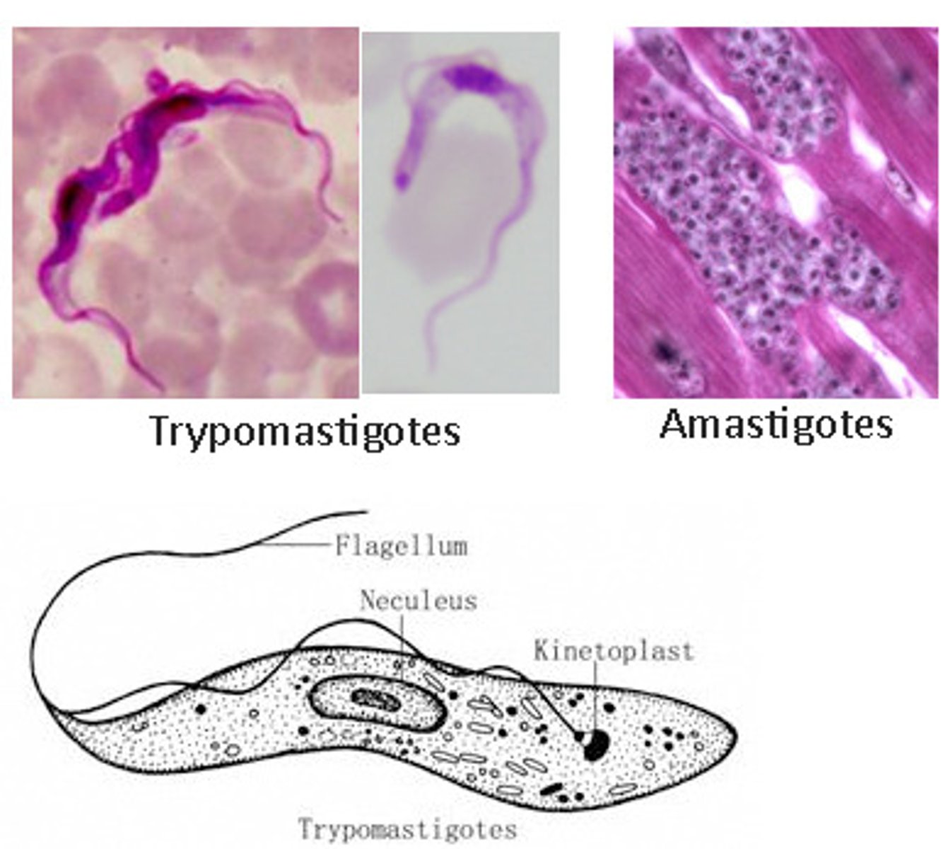 <p>very small, round, deep staining nucleus, kinetoplast; for T. cruzi found in heart tissue</p>