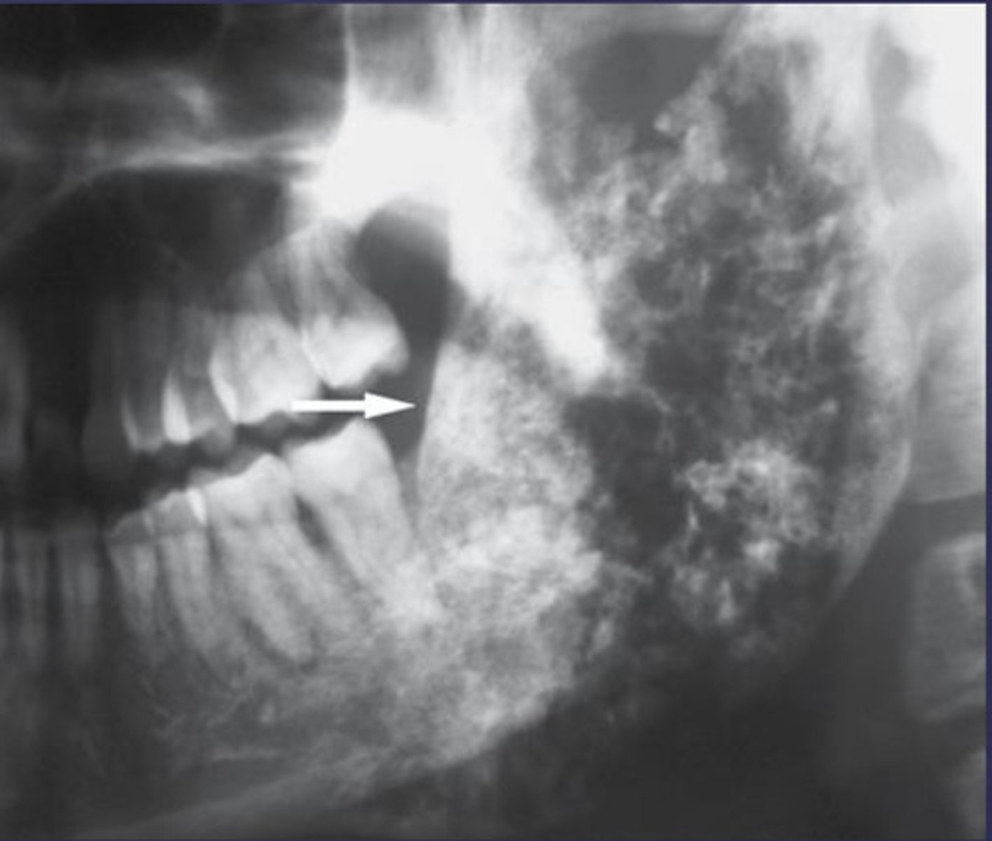 <p>What category would you put this lesion into?</p>