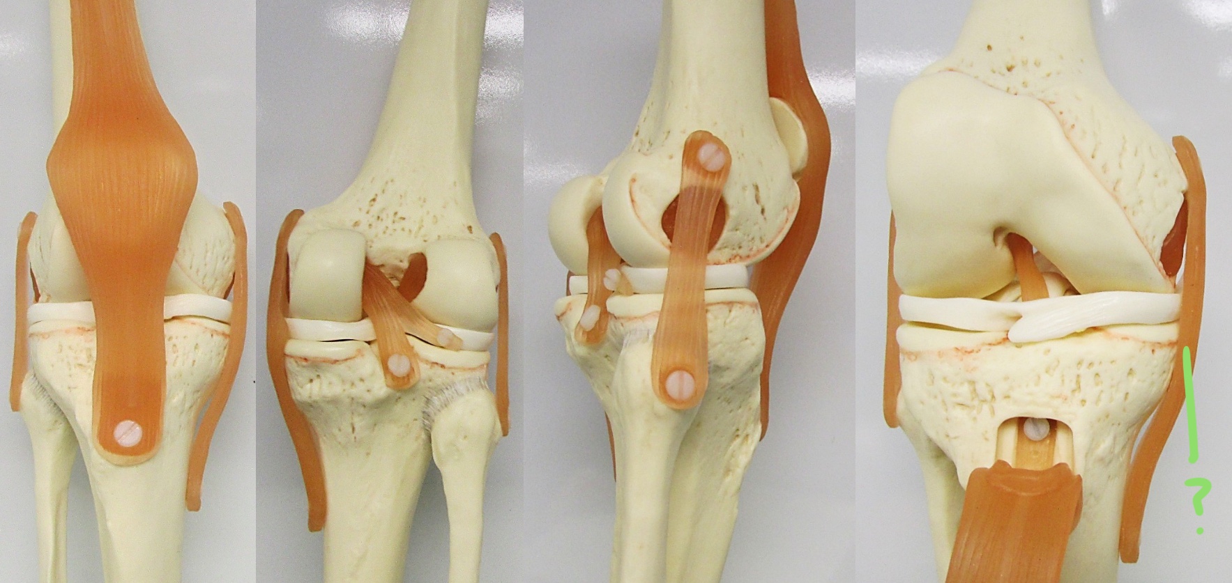 <p>Determine the part of the knee joint w/ ligament highlighted</p>