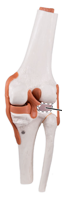 <p>What is the highlighted fibrocartilage?</p>