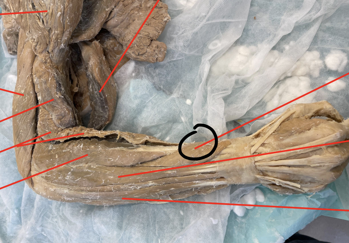 <p>identify + state origin, insertion, action, innervation of marked structure</p>