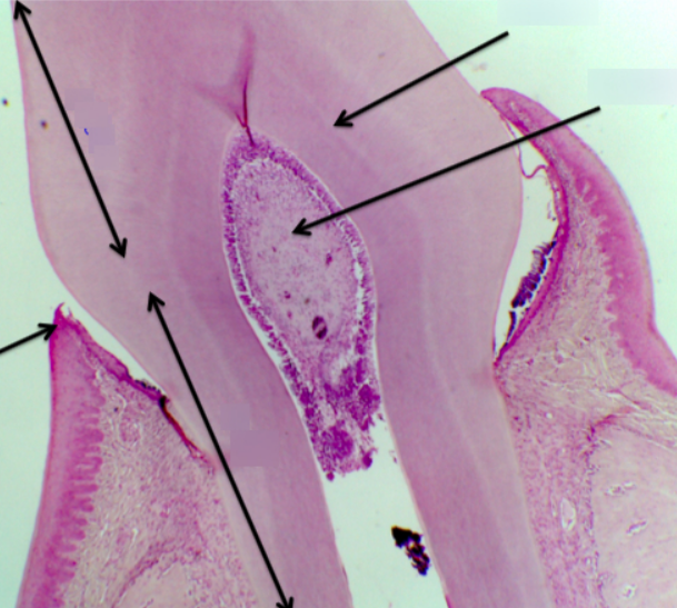<p>Organ?</p>