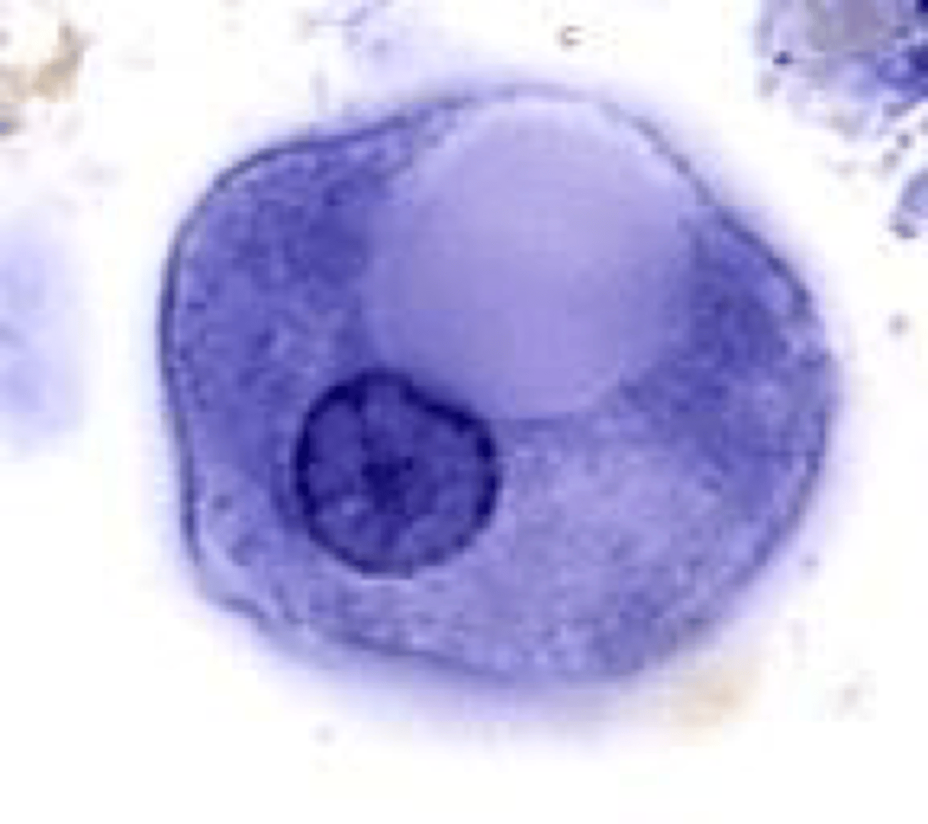 <p>Name the stage and species. NOTE: Nucleus with large central endosome with fine peripheral ring of chromatin. Also, note the large cytoplasmic vacuoles.</p>