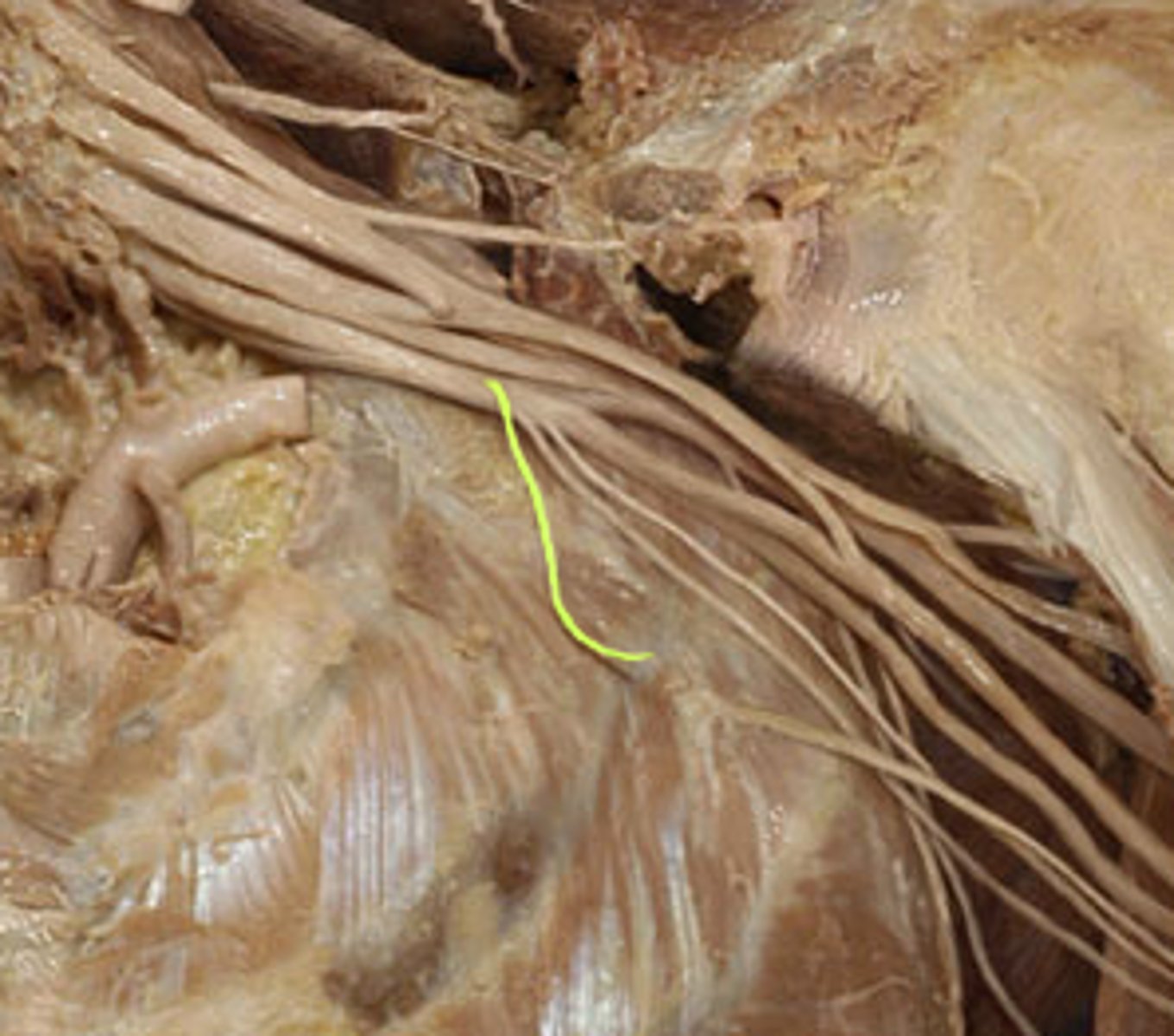 <p>What is this nerve?</p>