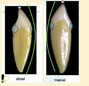 <p><mark data-color="#ffc1ec" style="background-color: #ffc1ec; color: inherit">mandibular canines #22 and #27; distal and mesial view</mark></p>