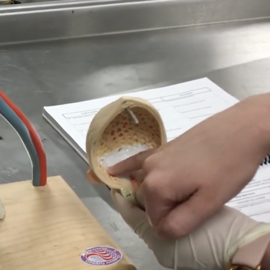 <p>Description: Openings of the ureters into the posterior inferior aspect of the urinary bladder</p><p>Relationship: Where urine enters the inferior portion of urinary bladder</p>