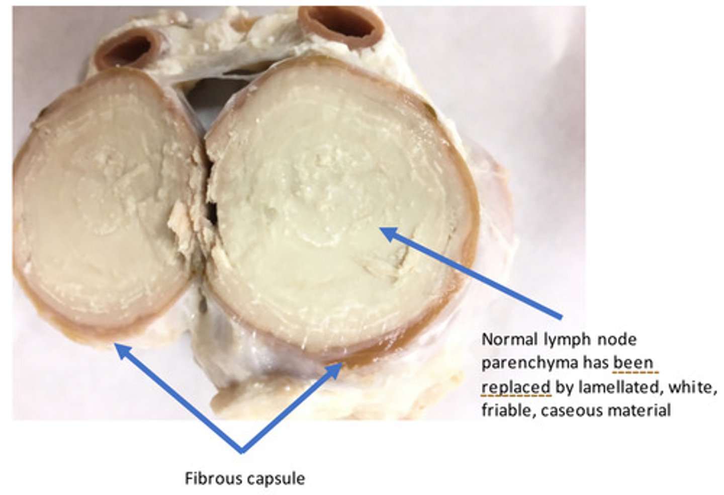 <p>What bacterial organism would cause this lesion in a sheep?</p>