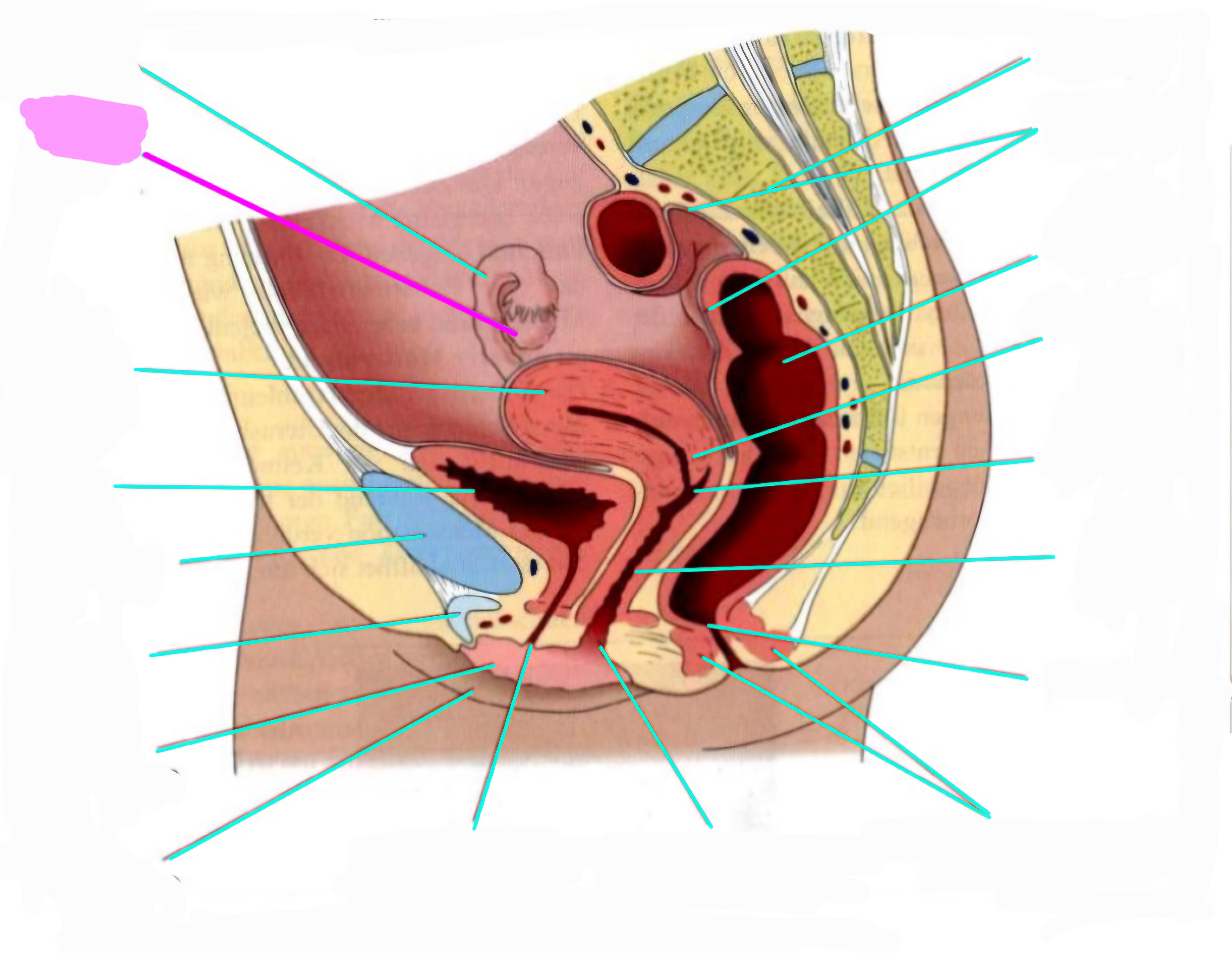term image