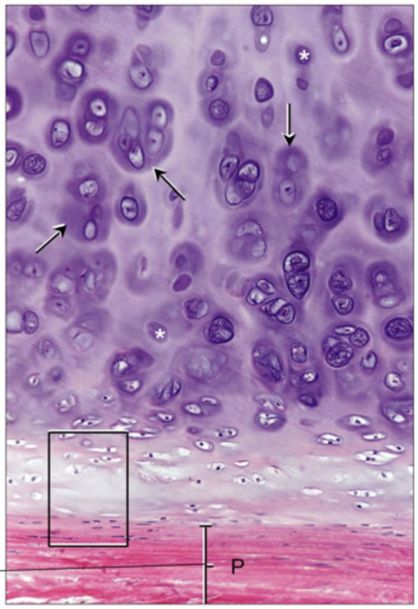 <p>Perikondrium, tät binväv</p>