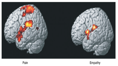 <p>the brain’s ? has the ability to ? the activity of another’s brain</p>