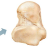 What class of bones is this?