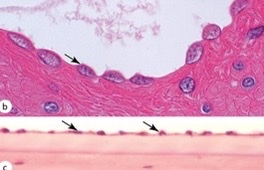 What type of epithelia?