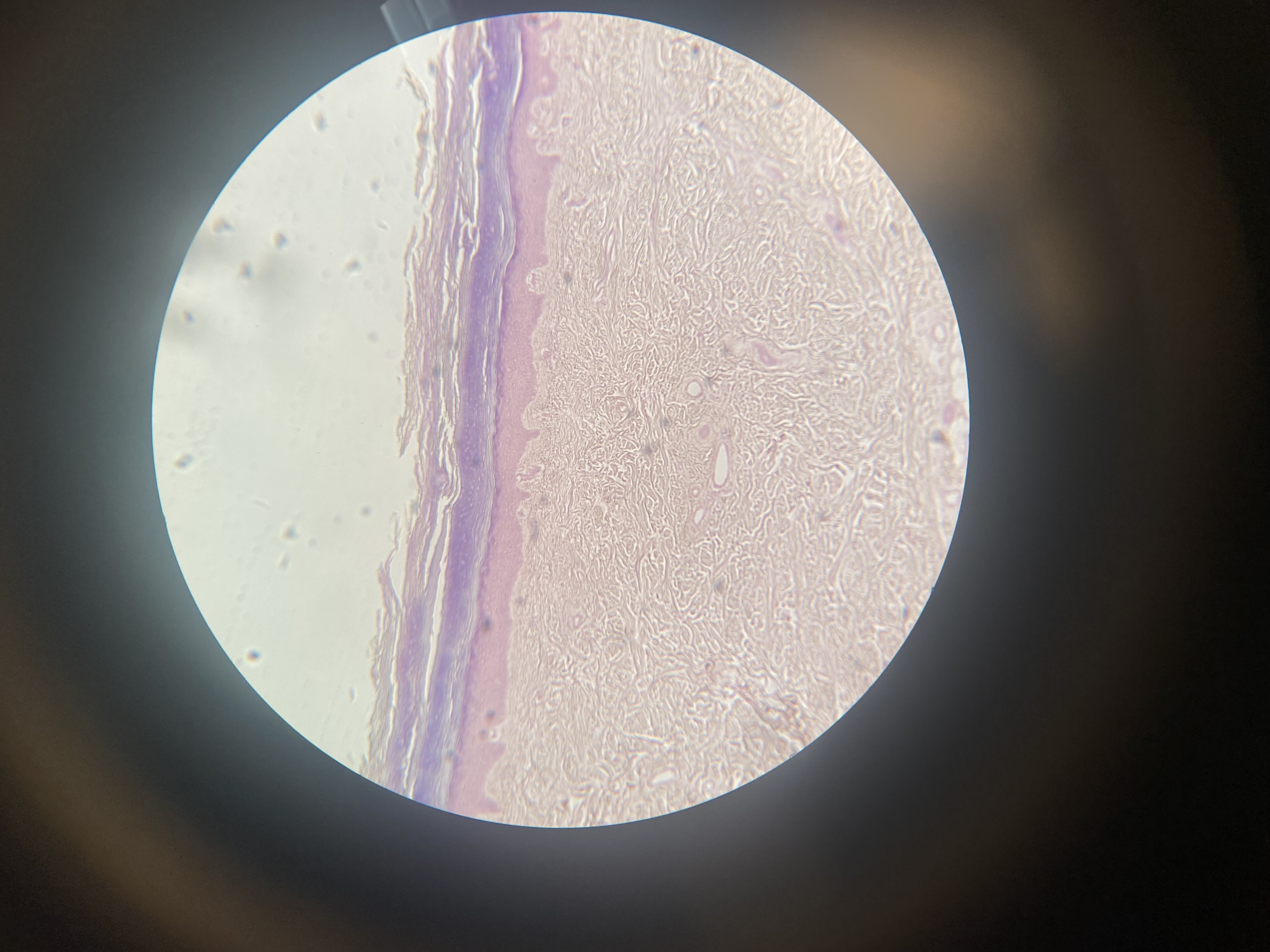 <p>Identify</p>