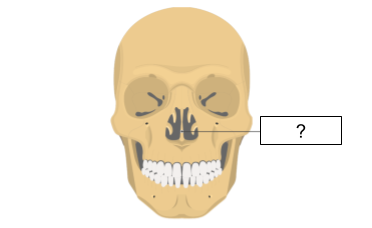 <p>What bone is this?</p>