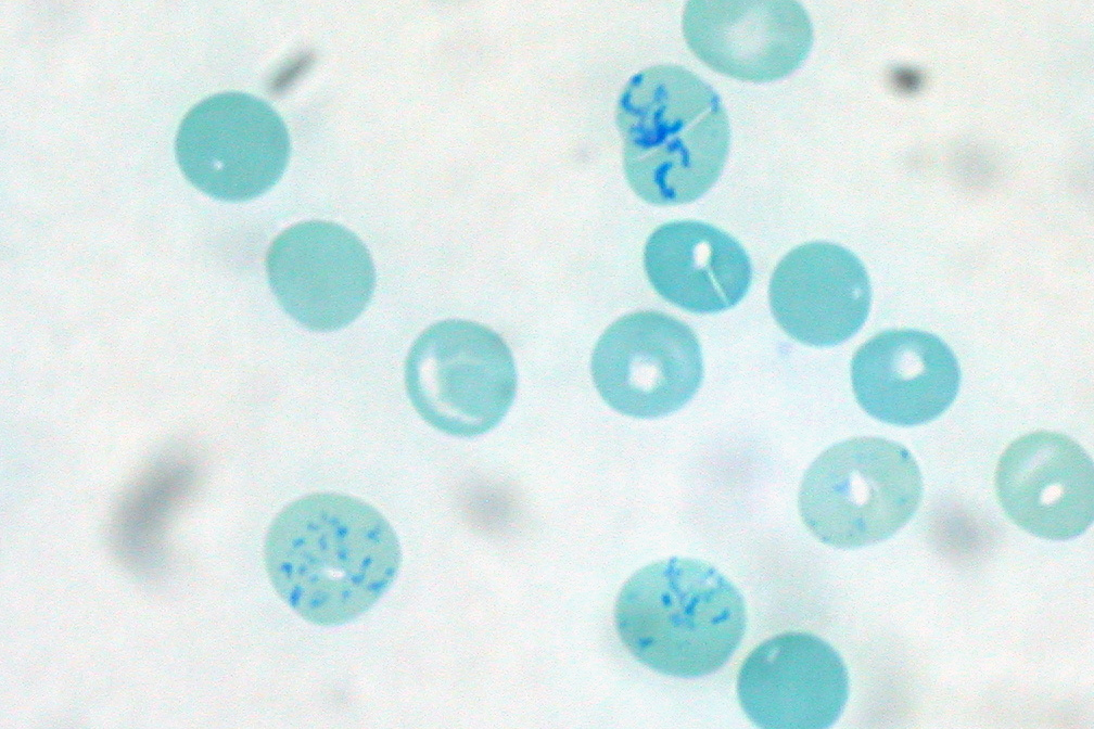 <p><strong>Non-Nucleated RBC</strong> with particles of <strong>blue-stained granular filamentous material</strong></p>