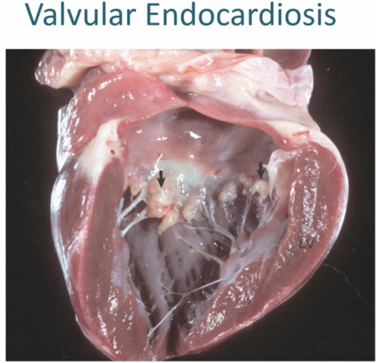<p>1. Degeneration of valvular collagen, most common cause of CHF in Dogs</p><p>2. Middle-aged to old small breed dogs</p><p>3. </p><p>Mitral valves: Shortened, thick nodular valves that appear smooth and shiny</p><p>Valvular insufficiency: Atrial Dilation, develop "jet lesions" (Rough firm streaks of fibrosis from trauma</p>