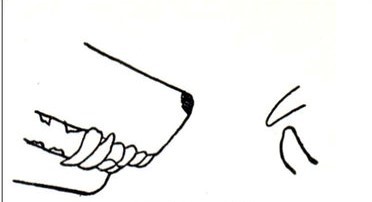 <p>upper front teeth projecting beyond the lower</p>