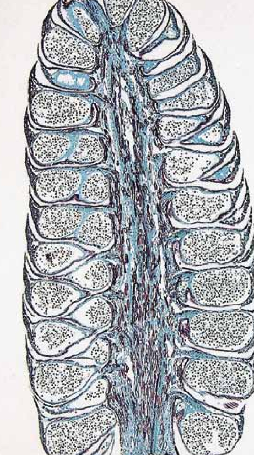 <p>Pollen-producing cones are borne on upper branches. </p><p>Contains microspore mother cells that undergo meiosis to 4 haploid microspores, that consists of two prothallhial cells, a generative cell and a tube cell. </p><p>4 called pollen grain is the immature micro gamtophyte </p>