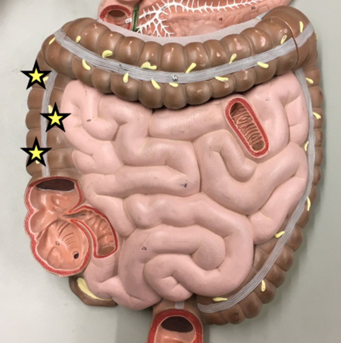 knowt flashcard image