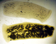 Mature proglottid of __________, stained with ___________. Note the number of primary uterine branches.