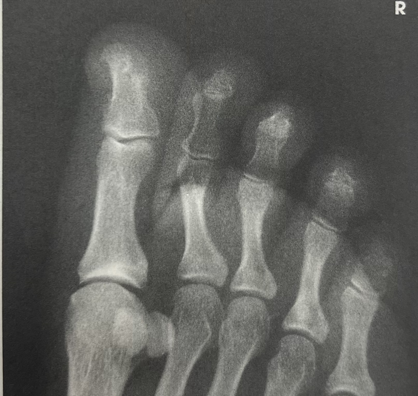 <p>identify the <strong>projection </strong>of the image </p>