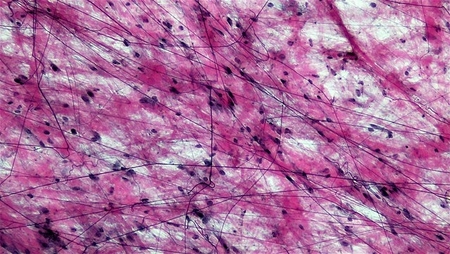 <p>Aeolar Tissue</p>