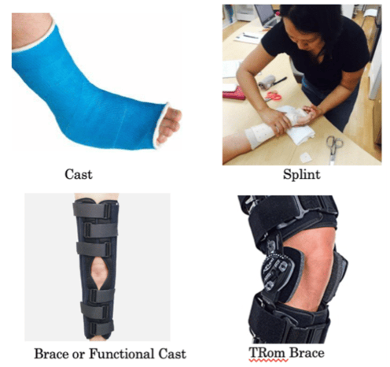 <p>-Cast<br>-Splint<br>-Brace or functional cast<br>-TRom brace</p>