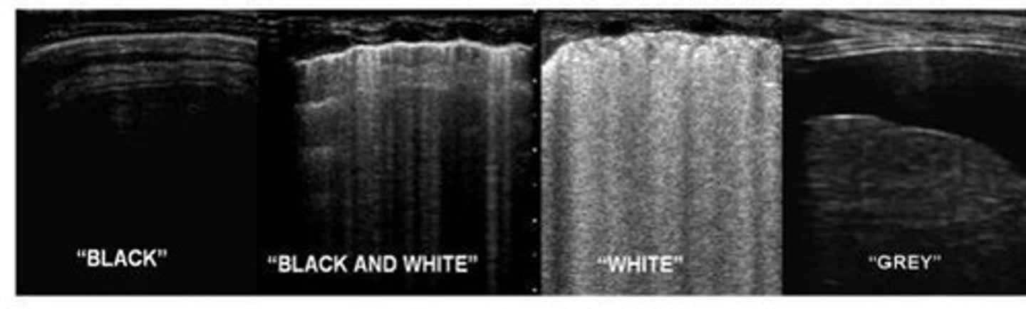 <p>Consolidation</p>