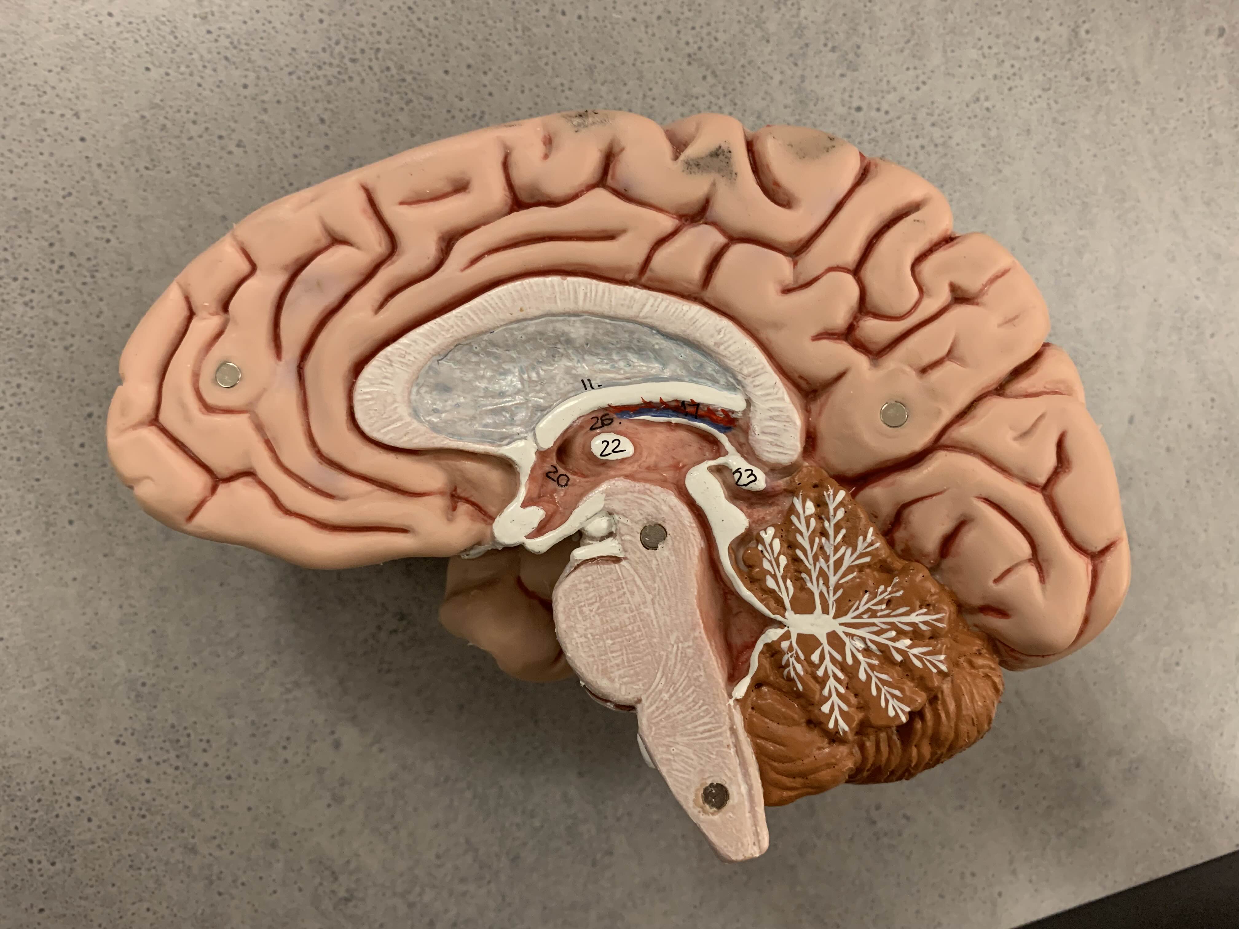 <p>Which part of the brain is:</p><ul><li><p>Half of the brain, left or right</p></li></ul><p></p>