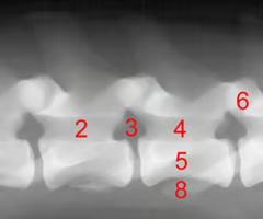 <p><span><span>Identify structure 6:</span></span></p>