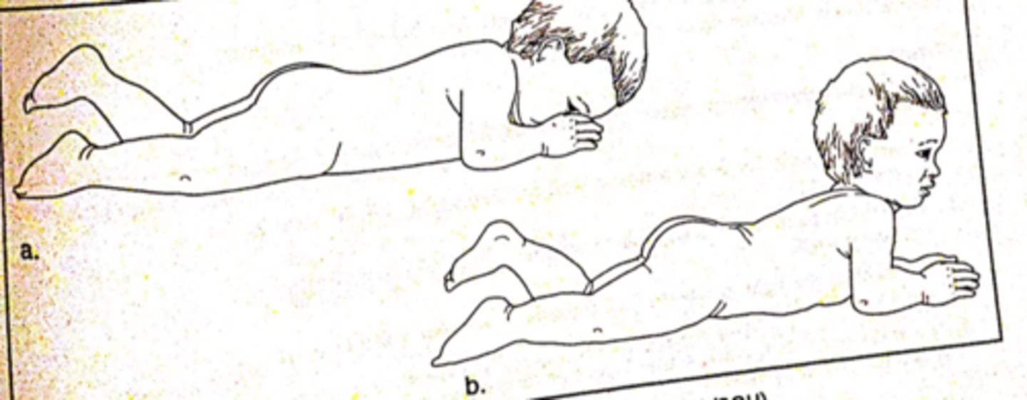 <p>body contacts surface</p><p>lift head away from surface (so they don't suffocate)</p><p>- onset birth-2 months</p>