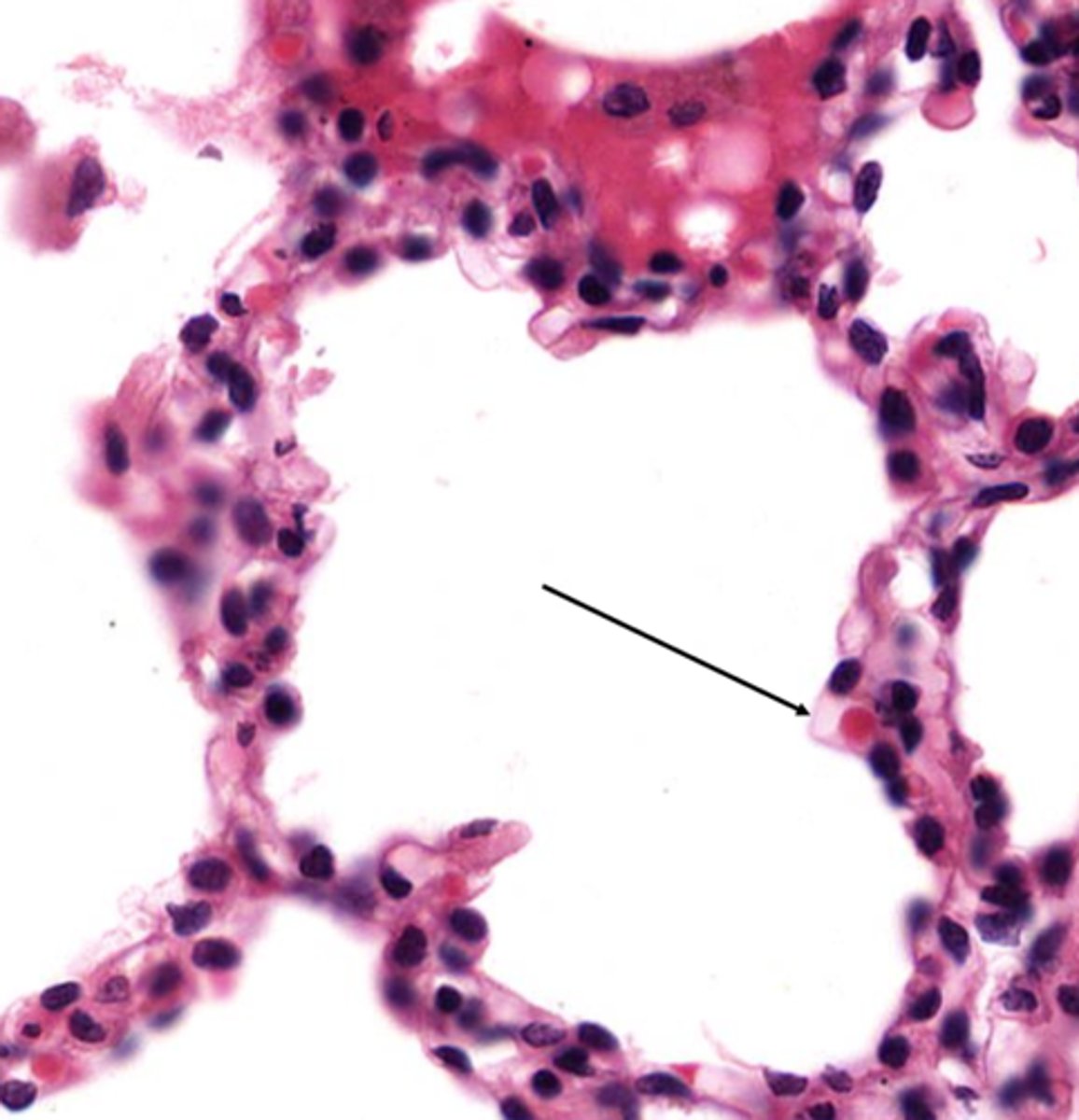 <p>Name the barrier located here</p>