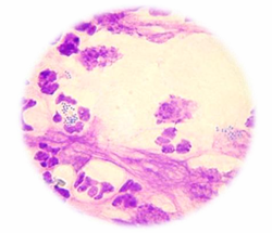 <p>Usually, staphylococci</p><ul><li><p>S. pseudintermedius dogs and cats</p></li><li><p>less so, S. aureus or S. schlieferi</p></li></ul><p></p>