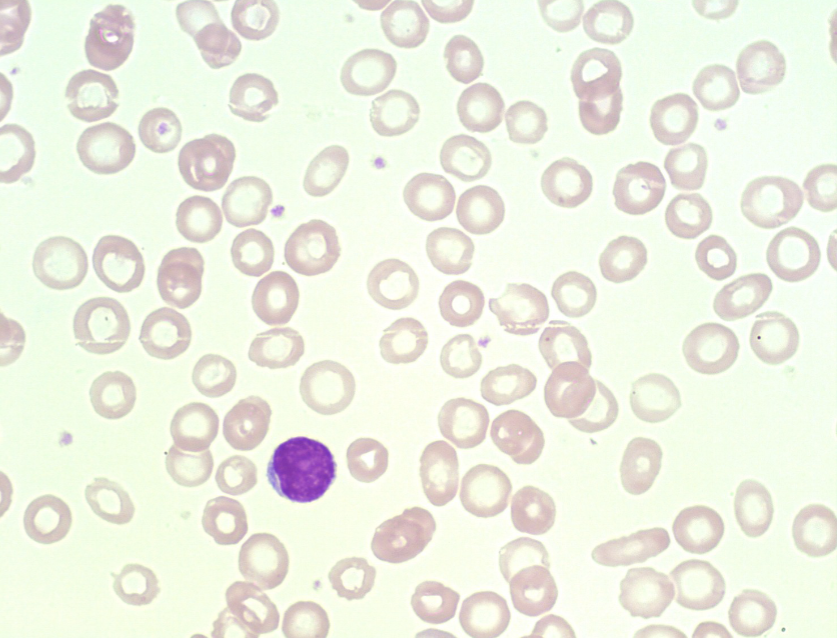 <p>are these cells normocytic, microcytic, or macrocytic?</p>