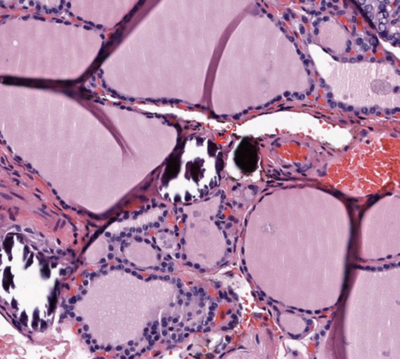 <p>Thyroid</p>