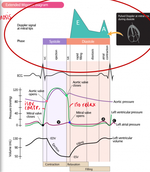 <p>E = rapid diastolic filling</p><p>A = atrial systole/kick </p>