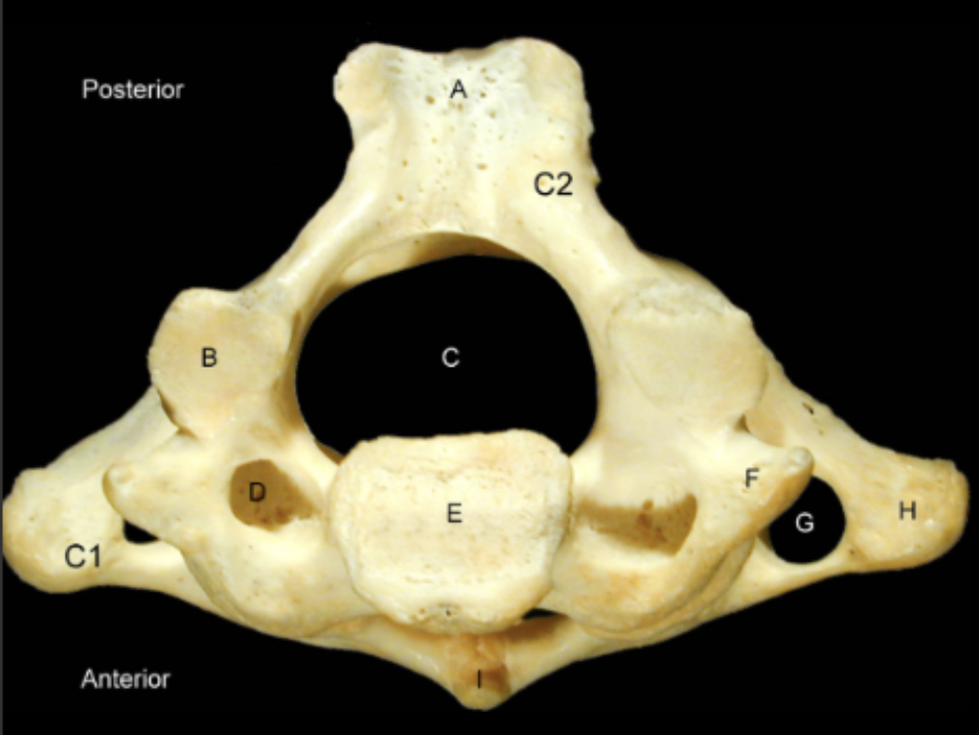 <p>Identify the Structures of the Cervical Vertebrae - Inferior View</p>