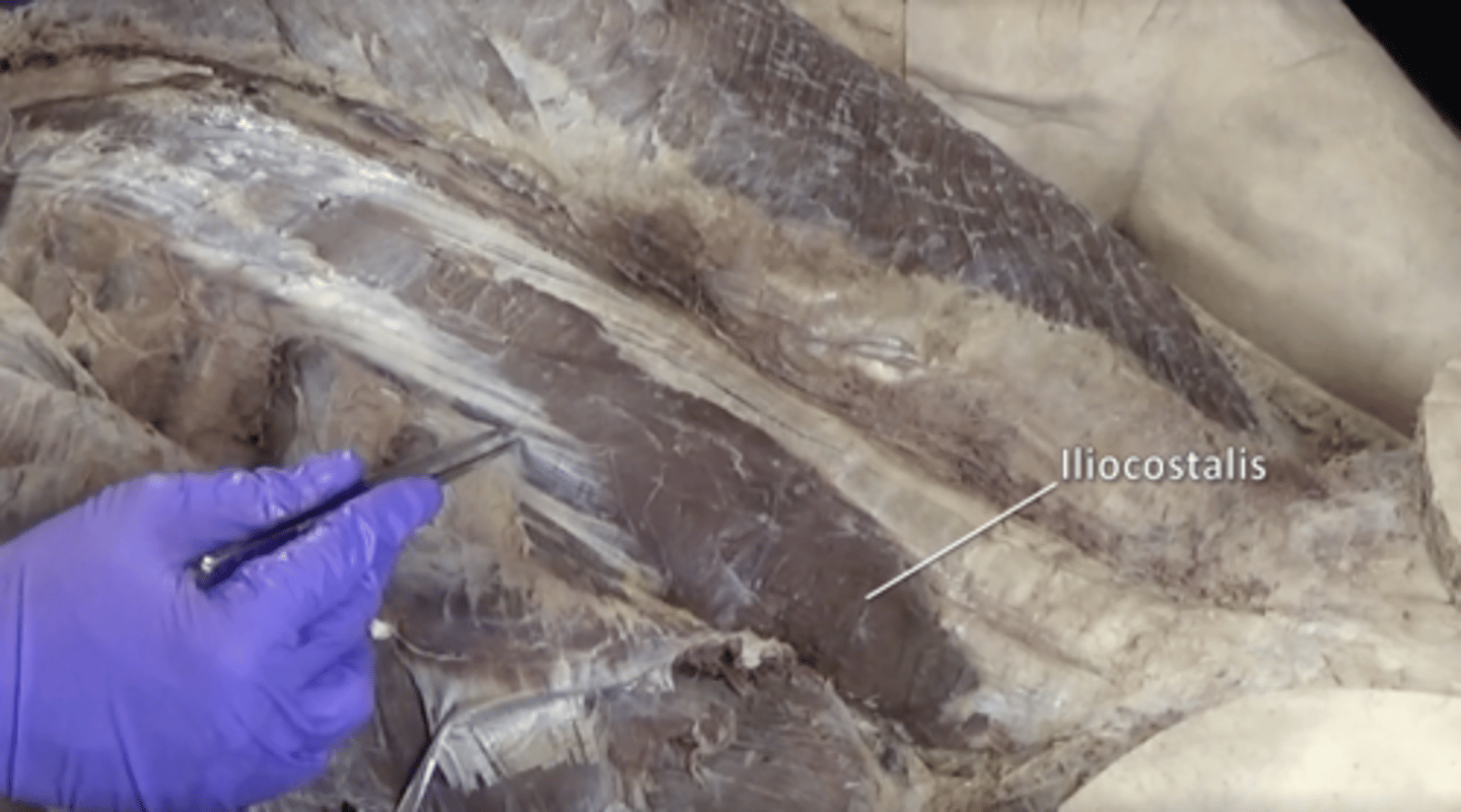 <p>Lateral muscle of the erector spinae group.</p>